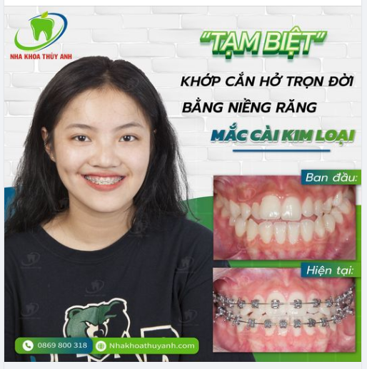 CỨ ĐI RỒI TA SẼ ĐẾN - CỨ KIÊN TRÌ TA SẼ ĐƯỢC NHẬN QUẢ NGỌT