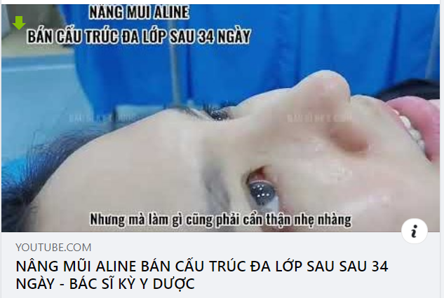 Cùng nghe chia sẻ của bạn khách sau 1 tháng tái khám.