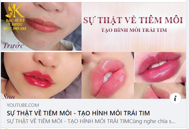Cùng nghe chia sẻ những từ chuyên gia về các phương pháp tiêm môi - tạo hình môi.