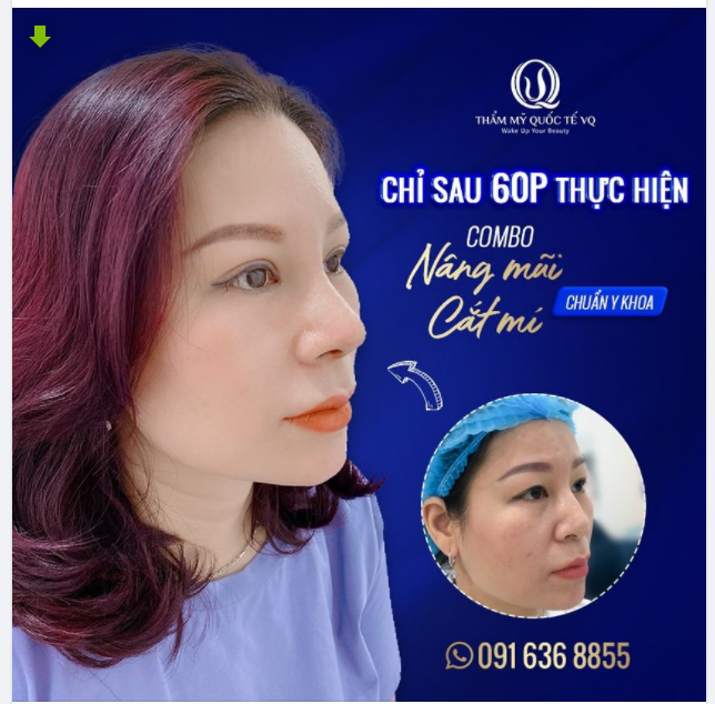 " CUỘC GẶP MẶT ĐỊNH MỆNH " - KHÁCH HÀNG ĐẾN VQ LÀM ĐẸP