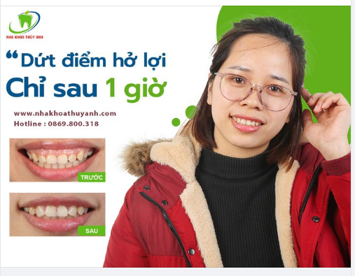 CƯỜI HỞ LỢI SAO PHẢI ĐỢI