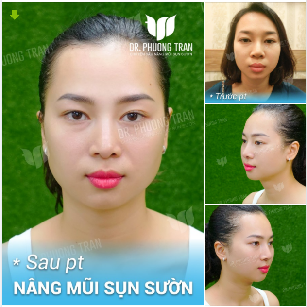 Cuối ngõ là con đường cùng Nhìn “em” một chút thẹn thùng u mê.