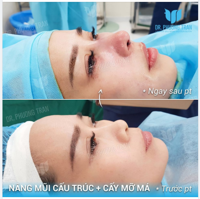 “ĐÃ LÀM LÀM CHO TỚI, ĐÃ ĐẸP ĐẸP MỘT THỂ”