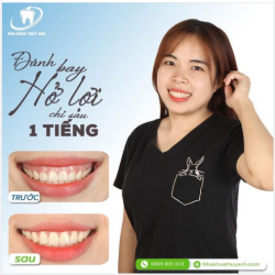 ĐĂNG KÝ LIỀN TAY HẾT BAY CƯỜI HỞ LỢI