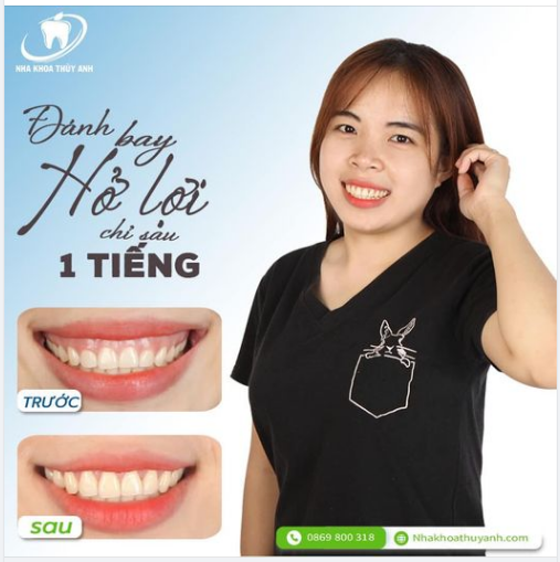 ĐĂNG KÝ LIỀN TAY HẾT BAY CƯỜI HỞ LỢI