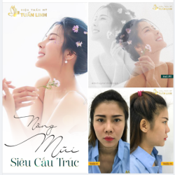 DÁNG MŨI ANGEL LINE GÂY " NHỚ THƯƠNG" NHÀ TUẤN LINH