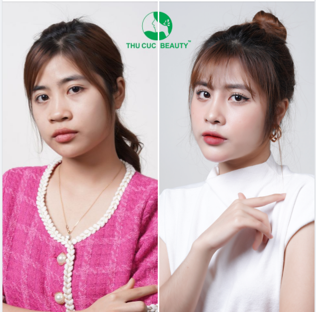 DÁNG MŨI CAO SANG - MẶT ĐẸP QUÝ PHÁI