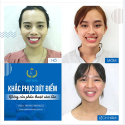 ĐÁNH BAY HÔ, MÓM KHÔNG CẦN PHẪU THUẬT XÂM LẤN