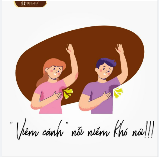 Đánh bay "viêm cánh" với công nghệ trị chứng tăng tiết mồ hôi miraDry.