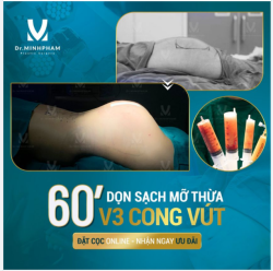 ĐẶT CỌC ONLINE - NHẬN NGAY ƯU ĐÃI KẾT QUẢ CA NÂNG CẤP V3 ĐẸP XUẤT SẮC ĐƯỢC KIẾN TẠO BỞI DR MINH PHẠM
