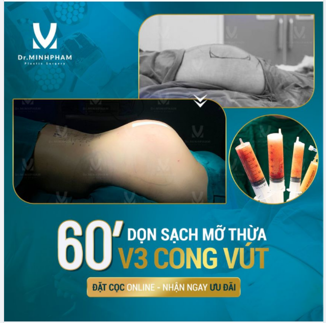 ĐẶT CỌC ONLINE - NHẬN NGAY ƯU ĐÃI KẾT QUẢ CA NÂNG CẤP V3 ĐẸP XUẤT SẮC ĐƯỢC KIẾN TẠO BỞI DR MINH PHẠM