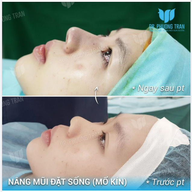 ĐẶT SỐNG ĐƠN GIẢN MÀ ĐẸP LÊN BẤT NGỜ