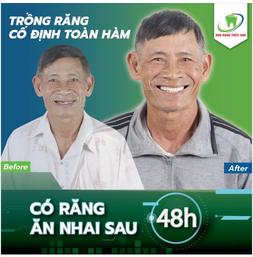 ĐẦU TƯ MỘT LẦN - ĂN NHAI TRỌN ĐỜI SAU TRỒNG ALL ON 4