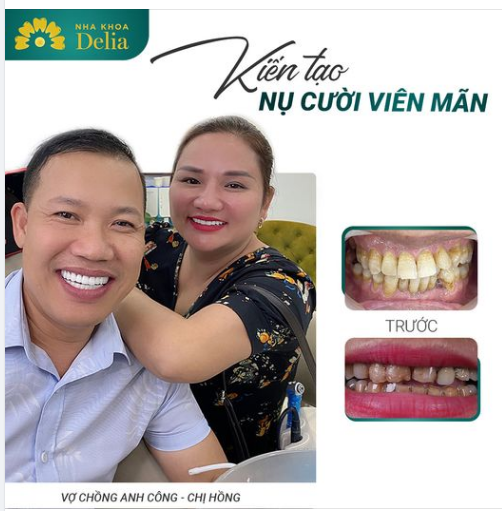DELIA KIẾN TẠO NỤ CƯỜI VIÊN MÃN