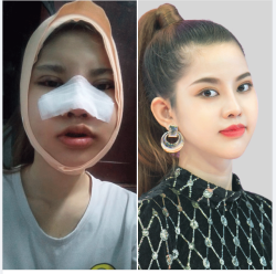 ĐẸP chất Hàn Quốc - Chi phí "Việt" - có đúng mong muốn chị em?