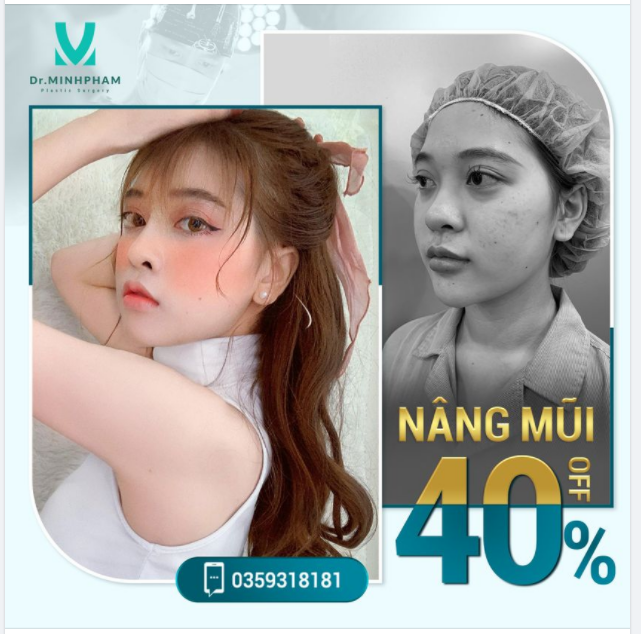 ĐẸP ĐI – CHỜ CHI NÂNG MŨI ME SHAPE TẶNG 40% CHI PHÍ