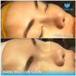 ĐẸP HƠN KHÔNG KHÓ NHƯ BẠN NGHĨ