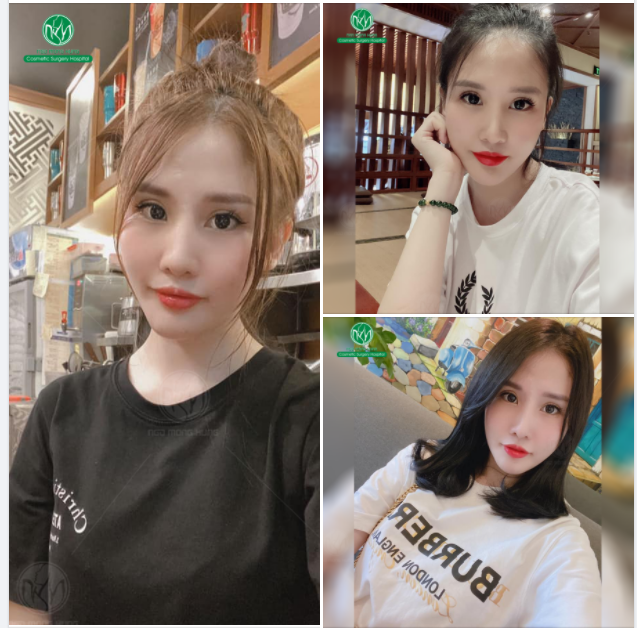 ĐẸP NGẨN NGƠ VỚI ĐÔI MẮT 2 MÍ TO TRÒN