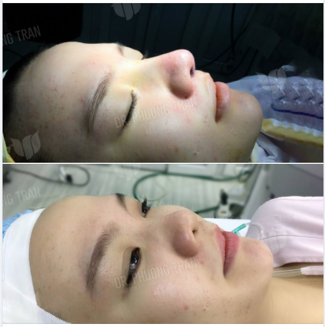 ĐẸP NGAY SAU PHẪU THUẬT LÀ CÓ THẬT