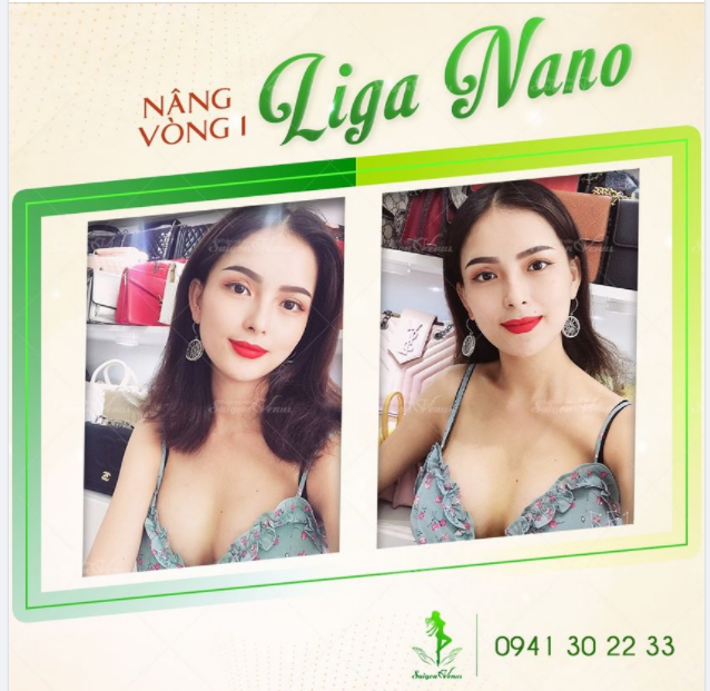 ĐẸP NHƯ NỮ THẦN SAU MÀN "LỘT XÁC" CÙNG LIGA NANO