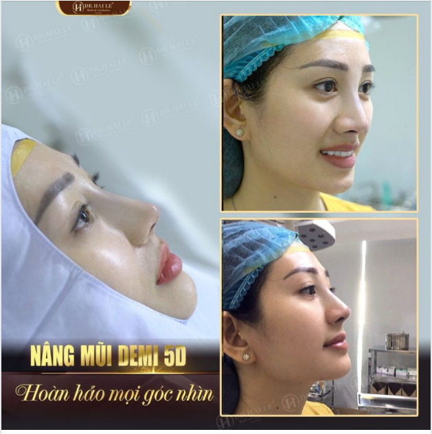 "ĐẸP NỨC NỞ": Góc nghiêng "gây thương nhớ" được hàng ngàn khách hàng Dr.Hải Lê yêu thích