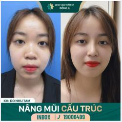 Đi đâu mà vội mà vàng Dừng chân đứng lại ngắm nàng Mũi Xinh