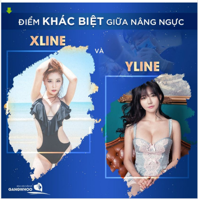 ĐIỂM KHÁCH BIỆT GIỮA NÂNG NGỰC DÁNG X-LINE VÀ Y-LINE