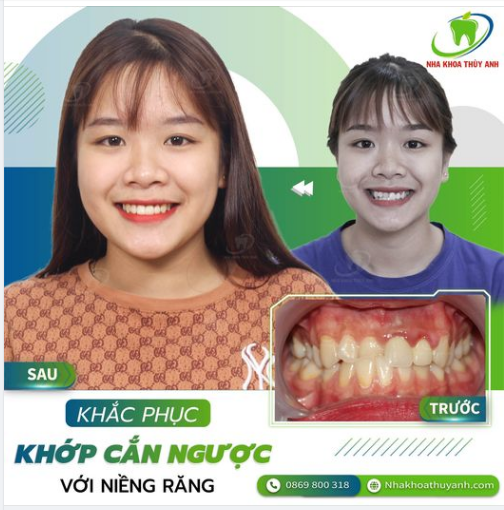ĐIỀU GÌ ĐANG CẢN TRỞ NỤ CƯỜI TƯƠI TẮN CỦA BẠN?