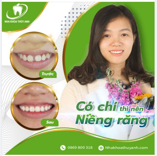 ĐIỀU GÌ KHIẾN BẠN CHƯA NIỀNG RĂNG ĐỂ ĐƯỢC CƯỜI RẠNG RỠ?