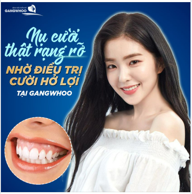 ĐIỀU TRỊ CƯỜI HỞ LỢI CHO NỤ CƯỜI THẬT RẠNG RỠ