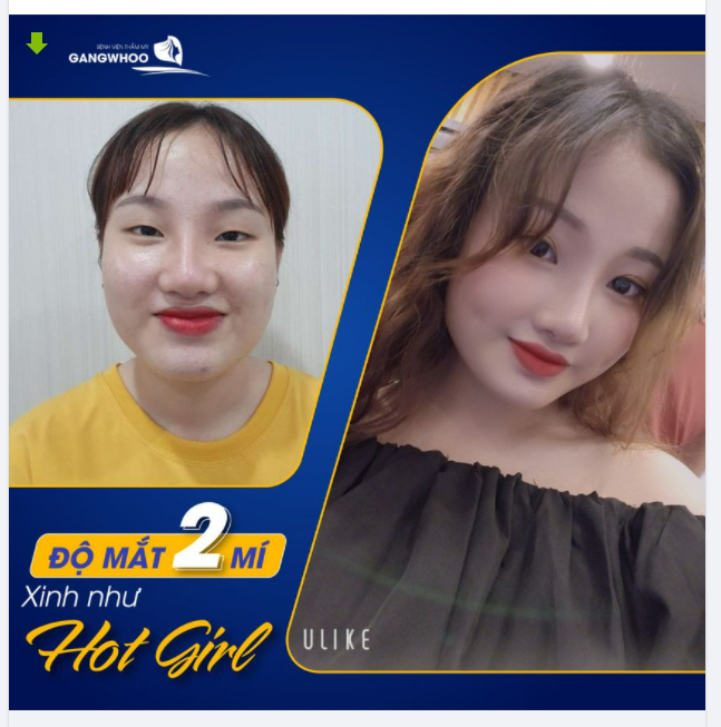 ĐỘ MẮT 2 MÍ - XINH NHƯ HOTGIRL