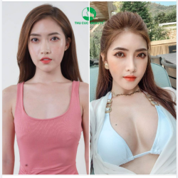 "ĐỘ" V1 TRÒN CĂNG - CHI PHÍ CỰC PHẢI CHĂNG