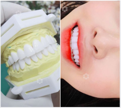 ĐOÁN VẬN MỆNH QUA TƯỚNG RĂNG XẤU VÀ CÁCH GIẢI QUYẾT