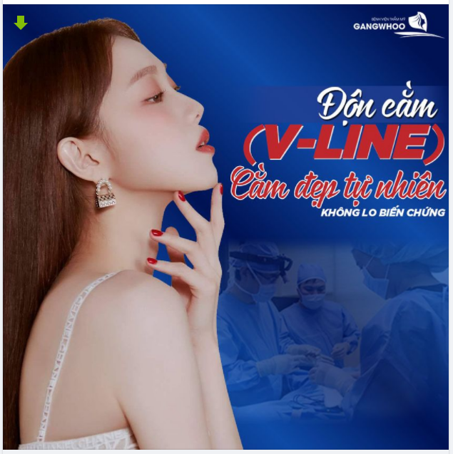 ĐỘN CẰM VLINE - CẰM ĐẸP TỰ NHIÊN, KHÔNG LO BIẾN CHỨNG