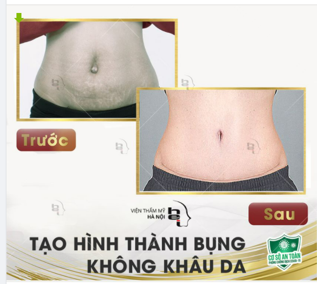 DỌN SẠCH MỠ THỪA VÀ DA CHÙNG CHỈ SAU 90 PHÚT