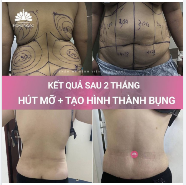 DỌN THÂN HÌNH MÀU MỠ - RẠNG RỠ ĐÓN ĐƯỜNG CONG
