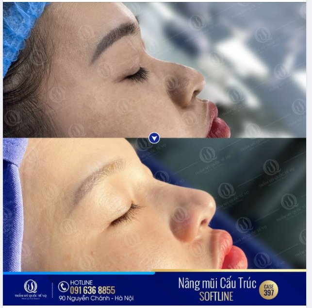 DR VŨ QUANG - SỬA MŨI HỎNG - CHỮA LÀNH TÂM HỒN - LẤY LẠI NIỀM TIN
