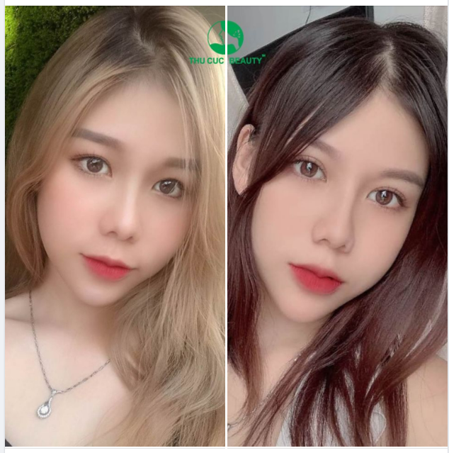 ĐỪNG BỎ LỠ CƠ HỘI SỞ HỮU ĐÔI MẮT ĐẸP "HÚT HỒN" VỚI GIÁ CHỈ TỪ 4.5 TRIỆU