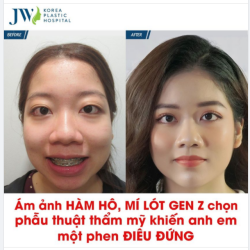 Đừng nghĩ HÀM HÔ, MẮT MỘT MÍ là bất trị, Genz hóa HOTGIRL khiến anh em TÉ NGỬA