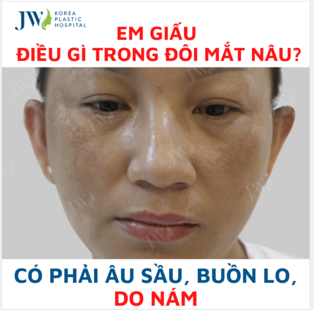 Em giấu điều gì trong đôi mắt nâu Có phải âu sầu, buồn lo, DO NÁM