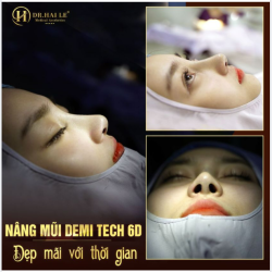 Em hiếm khi nói Say Yes với người khác. Nhưng chắc chắn đối với NÂNG MŨI DEMI TECH6D, em không thể "Say No"