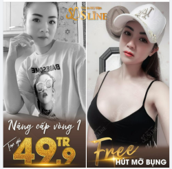 FEEDBACK khách hàng nâng cấp vòng 1 với ekip Sline