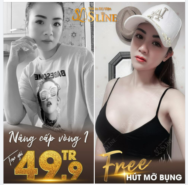 FEEDBACK khách hàng nâng cấp vòng 1 với ekip Sline