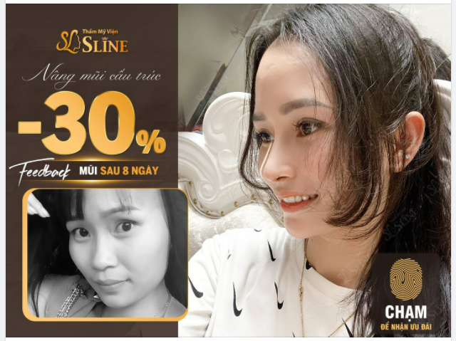 FEEDBACK MŨI CẤU TRÚC SOFTXIL SAU 8 NGÀY