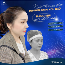 FEEDBACK MŨI ĐẸP TỪ CHỊ GÁI M.H. ĐẾN TỪ VŨNG TÀU