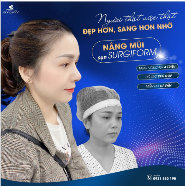 FEEDBACK MŨI ĐẸP TỪ CHỊ GÁI M.H. ĐẾN TỪ VŨNG TÀU