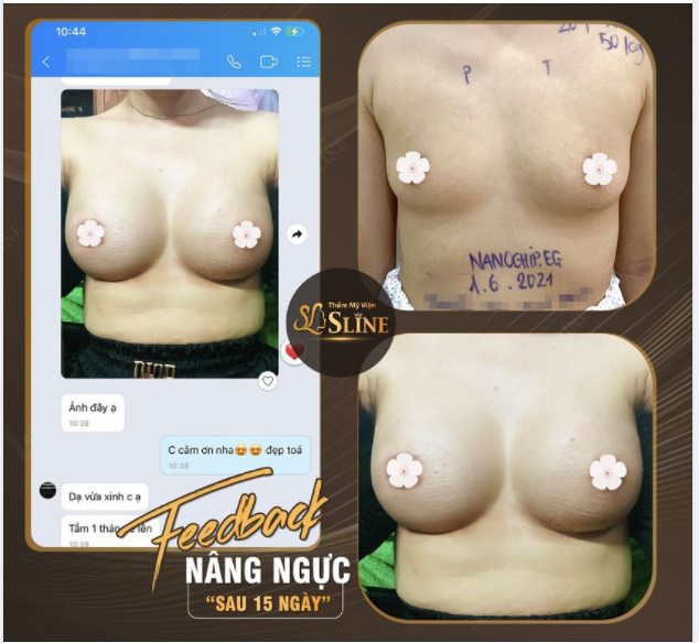 FEEDBACK nâng cấp vòng 1....Với dòng túi Nanochip Ergonomix.
