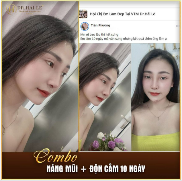 Feedback siêu chill từ cô nàng Trần Phương