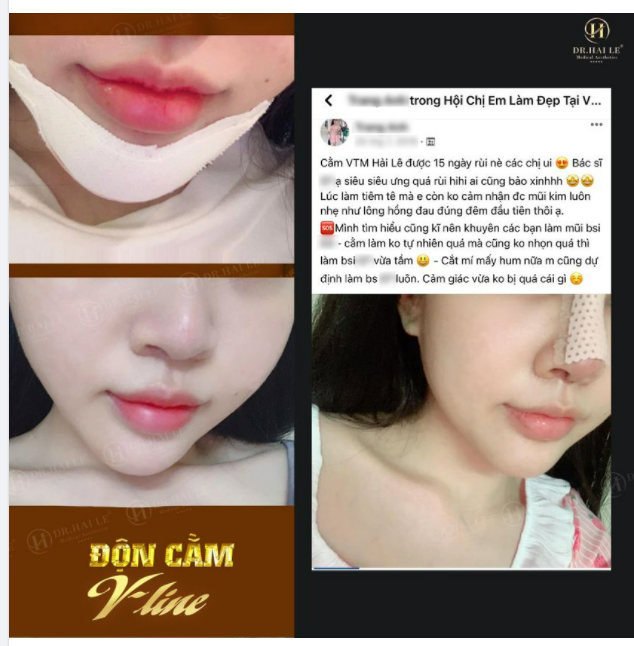 Feedback siêu chill từ cô nàng Trang.A