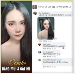 "Feedback siêu cool sau 1 năm thực hiện combo Nâng mũi + Cắt mí